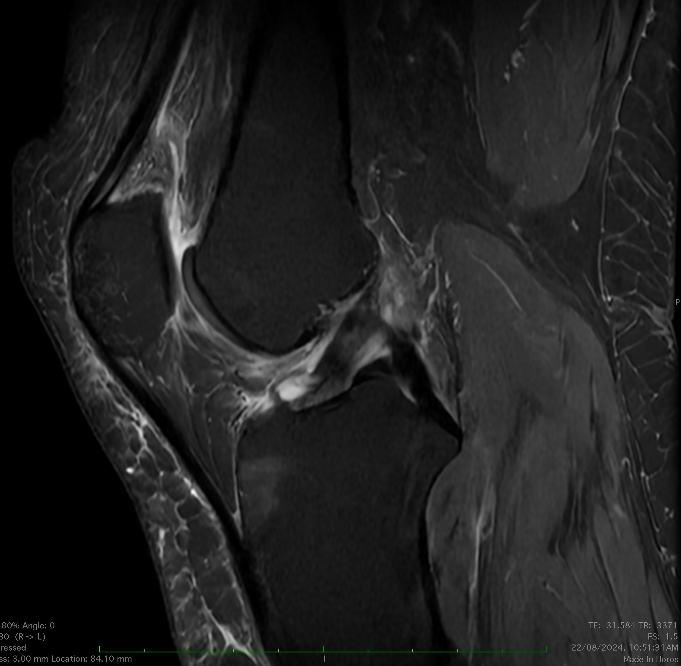 Lower Body Parts